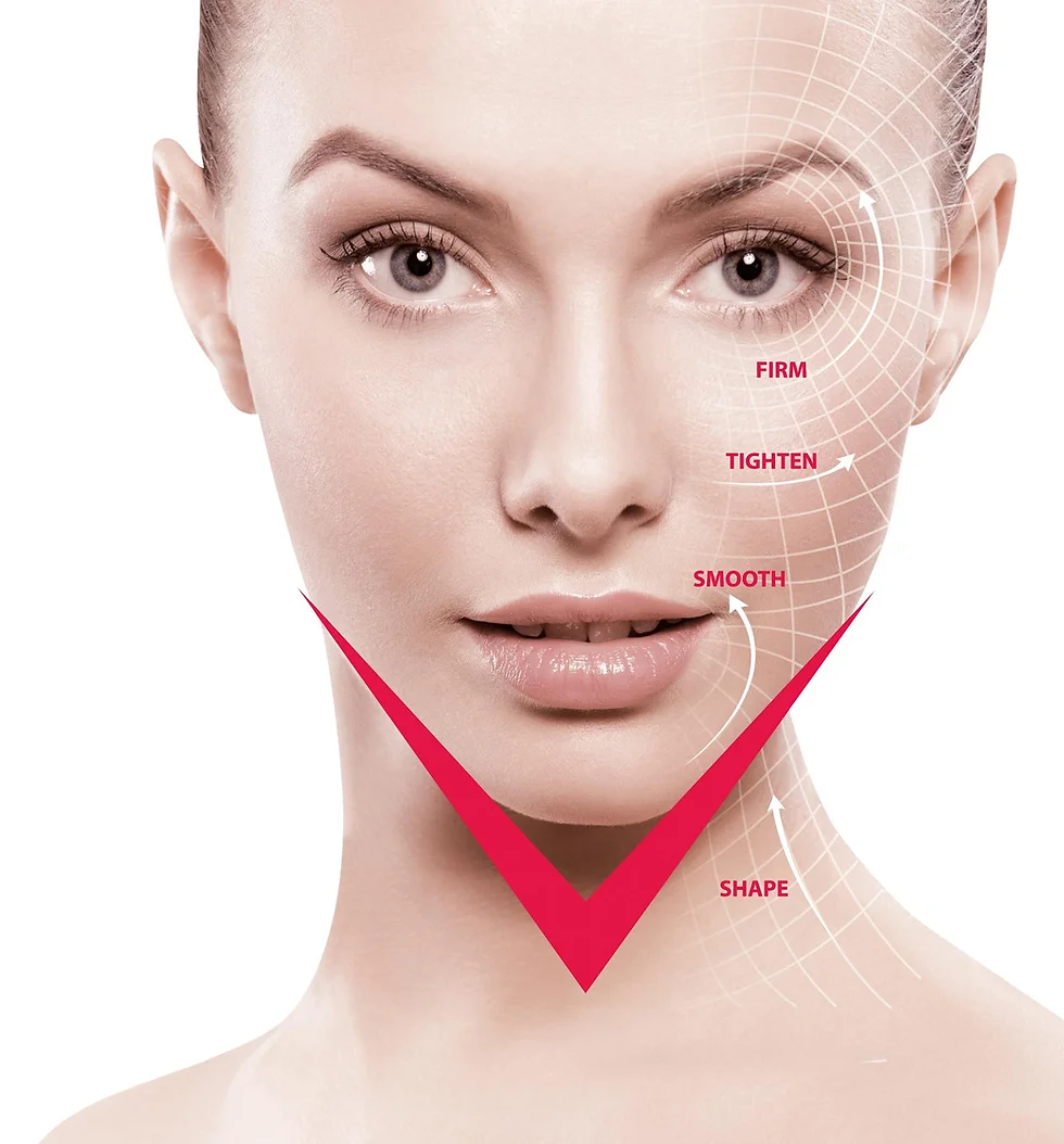 Benang Muka (V-shape)