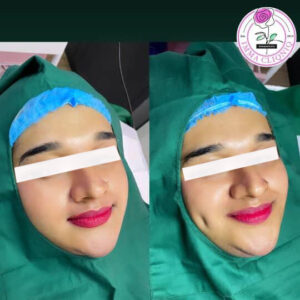 DIMPLE - Image 2