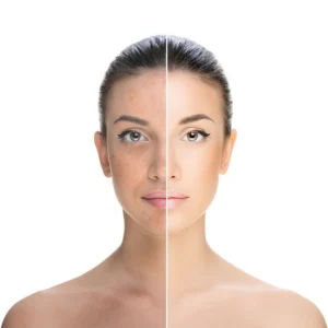 Pigmentation - Image 2