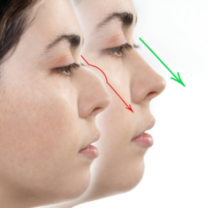 Benang Hidung & Tip Nose - Image 8