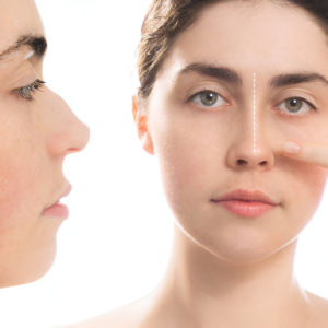 Benang Hidung & Tip Nose - Image 7