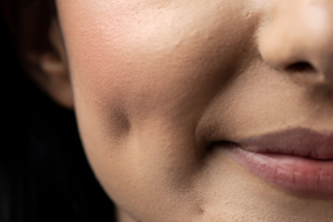 DIMPLE - Image 4
