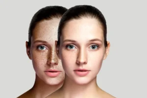 Pigmentation - Image 4