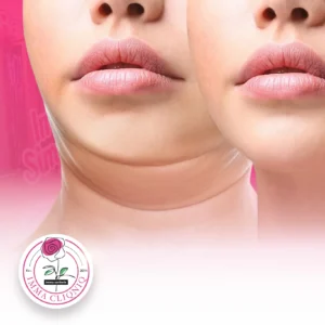 Benang Cog Double Chin - Image 2